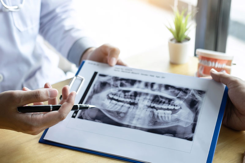 dentist holding a dental xray