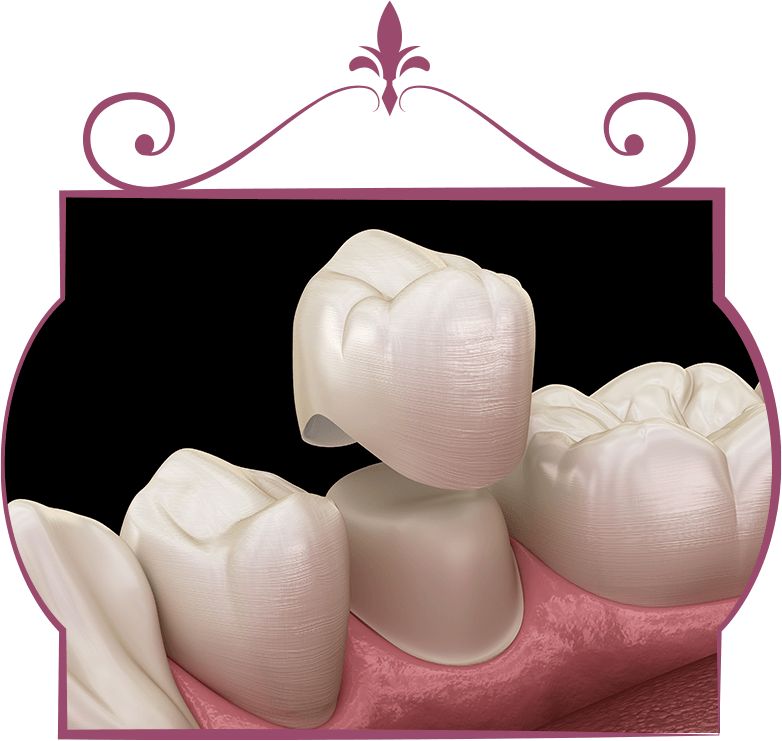 Crowns