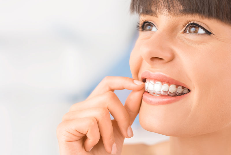 Invisalign