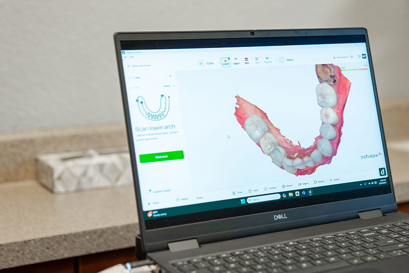 3d scan of teeth