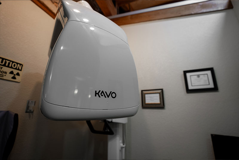 cbct close up