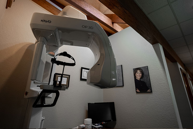 cbct machine